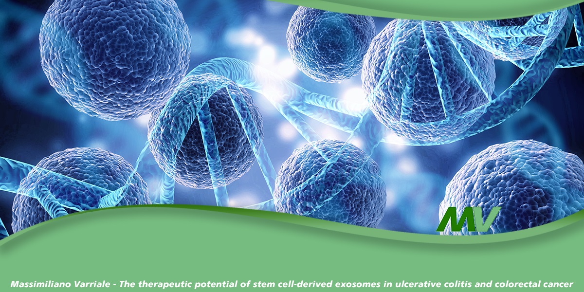 The therapeutic potential of stem cell-derived exosomes in ulcerative colitis and colorectal cancer